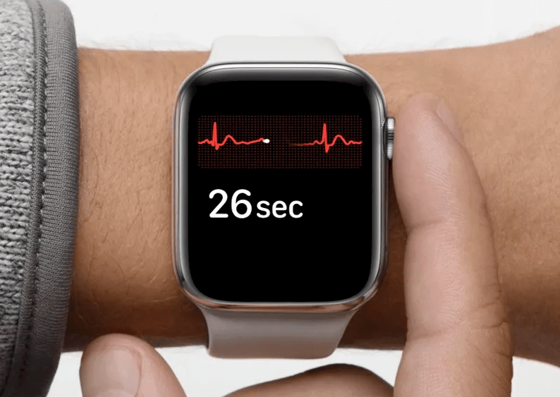 Apple Watch znowu pomógł wykryć zaburzenia rytmu serca – bigeminię komorową